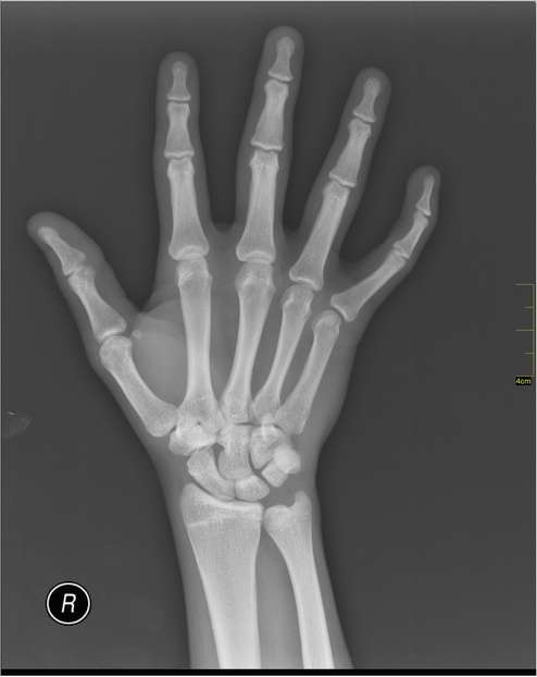 X-ray imaging Image