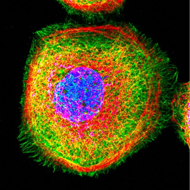 Confocal Scanning Microscopy Image