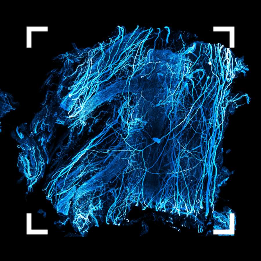 Innervation of human adipose tissue by Hongcheng Mai, Jie Luo, and Ali Ertürk (Helmholtz Munich) - ©Helmholtz Imaging. On this image the potential of nerve to modulate the metabolism of fatty tissue becomes visible. The research team first used the Tyrosine Hydroxylase antibody to stain the sympathetic nerve in human adipose tissue and tissue clear, and then light sheet microscopy imaging.

2nd place Public Choice Award