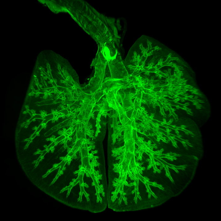 Light sheet fluorescence microscopy Image
