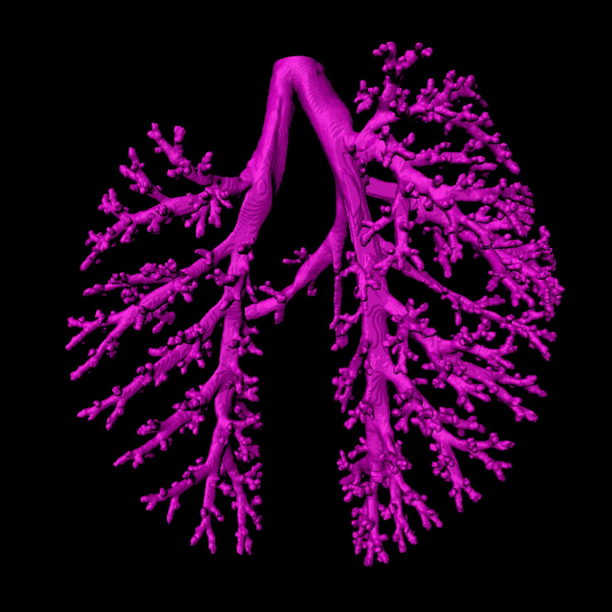 Covid-19 lung tissue visualisation Image