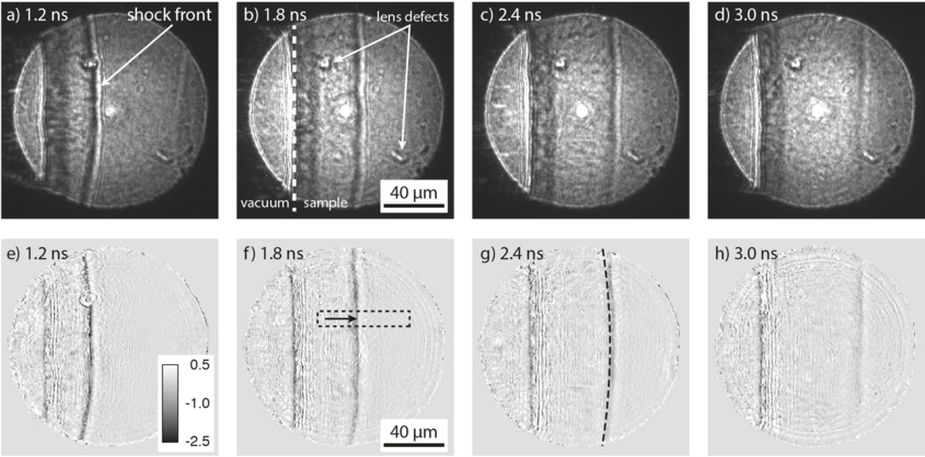Phase-contrast X-ray imaging Image